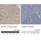 Anti-SLITRK1 Antibody