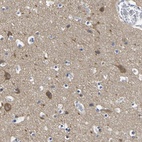 Immunohistochemical staining of human cerebral cortex shows high expression.