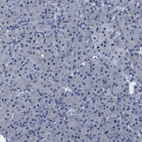 Immunohistochemical staining of human pancreas shows low expression as expected.