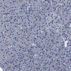 Anti-SLITRK1 Antibody