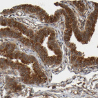 Immunohistochemical staining of human Fallopian tube shows moderate to strong cytoplasmic and membranous positivity in glandular cells.