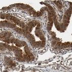 Immunohistochemical staining of human Fallopian tube shows moderate to strong cytoplasmic and membranous positivity in glandular cells.