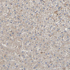 Immunohistochemical staining of human liver shows weak positivity in hepatocytes.