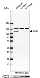 Western blot analysis in EFO-21 cells transfected with control siRNA, target specific siRNA probe #1 and #2, using Anti-OCRL antibody. Remaining relative intensity is presented. Loading control: Anti-GAPDH.