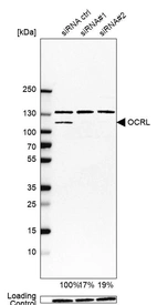 Western blot analysis in EFO-21 cells transfected with control siRNA, target specific siRNA probe #1 and #2, using Anti-OCRL antibody. Remaining relative intensity is presented. Loading control: Anti-GAPDH.