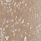 Anti-CNTN2 Antibody