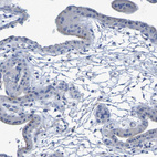 Anti-CNTN2 Antibody