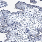 Immunohistochemical staining of human placenta shows no positivity in trophoblastic cells as expected.