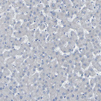 Anti-CNTN2 Antibody