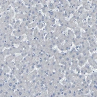 Immunohistochemical staining of human liver shows no positivity in hepatocytes as expected.