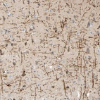 Immunohistochemical staining of human cerebral cortex shows strong positivity in neuronal processes in neuropil.