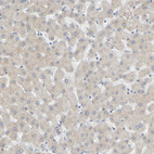Immunohistochemical staining of human liver shows very weak cytoplasmic positivity in hepatocytes.