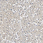 Immunohistochemical staining of human liver shows very weak cytoplasmic positivity in hepatocytes.