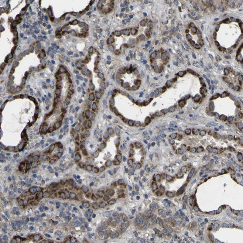 Anti-GPLD1 Antibody