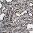 Anti-GPLD1 Antibody