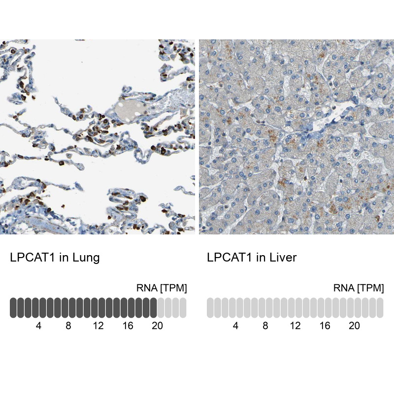Anti-LPCAT1 Antibody