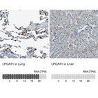 Anti-LPCAT1 Antibody