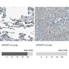 Anti-LPCAT1 Antibody