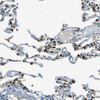 Immunohistochemical staining of human lung shows moderate to strong cytoplasmic positivity in pneumocytes.