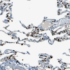 Immunohistochemical staining of human lung shows moderate to strong cytoplasmic positivity in pneumocytes.
