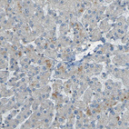 Immunohistochemical staining of human liver shows no positivity in hepatocytes as expected.