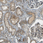 Immunohistochemical staining of human kidney shows weak to moderate cytoplasmic positivity in cells in tubules.