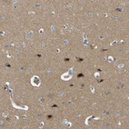 Immunohistochemical staining of human cerebral cortex shows moderate to strong cytoplasmic positivity in neurons.