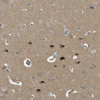Immunohistochemical staining of human cerebral cortex shows moderate to strong cytoplasmic positivity in neurons.