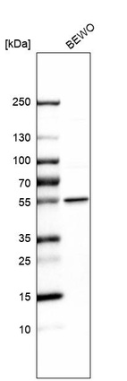 Western blot analysis in human cell line BEWO.