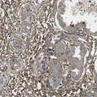 Immunohistochemical staining of human endometrium shows moderate cytoplasmic positivity in stromal cells.