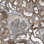 Immunohistochemical staining of human kidney shows moderate cytoplasmic positivity in cells in tubules.