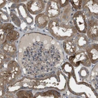 Immunohistochemical staining of human kidney shows moderate cytoplasmic positivity in cells in tubules.