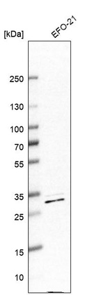 Western blot analysis in human cell line EFO-21.