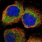 Immunofluorescent staining of human cell line A-431 shows localization to cytosol.