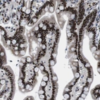 Immunohistochemical staining of human colon shows strong nuclear positivity in glandular cells.