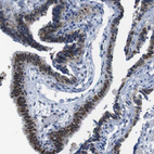 Immunohistochemical staining of human fallopian tube shows moderate nuclear positivity in glandular cells.