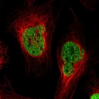 Immunofluorescent staining of human cell line U-2 OS shows localization to nucleoplasm.