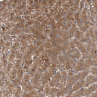 Anti-FBP1 Antibody