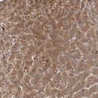 Anti-FBP1 Antibody