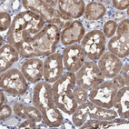 Immunohistochemical staining of human kidney shows moderate cytoplasmic positivity in cells in tubules.