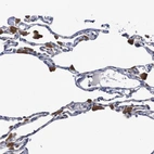 Immunohistochemical staining of human lung shows moderate to strong cytoplasmic positivity in macrophages.
