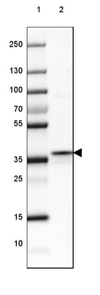 Lane 1: Marker [kDa] 250, 130, 100, 70, 55, 35, 25, 15, 10_br/_Lane 2: Human Skeletal muscle tissue
