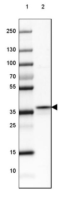 Anti-FBP1 Antibody