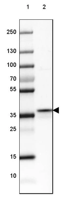 Lane 1: Marker [kDa] 250, 130, 100, 70, 55, 35, 25, 15, 10_br/_Lane 2: Human Skeletal muscle tissue
