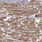 Immunohistochemical staining of human heart muscle shows strong cytoplasmic granular positivity in cardiomyocytes.