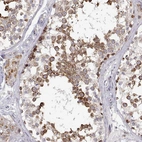 Immunohistochemical staining of human testis shows strong cytoplasmic granular positivity in seminiferous ducts.