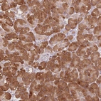 Anti-TMED6 Antibody