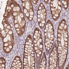 Immunohistochemical staining of human colon shows strong cytoplasmic positivity in glandular cells.