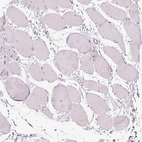 Immunohistochemical staining of human skeletal muscle shows no positivity in myocytes as expected.