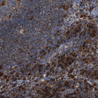 Anti-PTPN1 Antibody